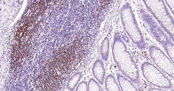 BOB1 Mouse Monoclonal Antibody