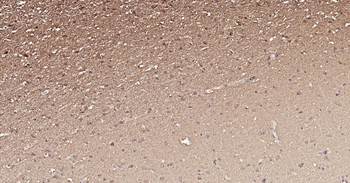 PIK3R3 Recombinant Rabbit Monoclonal Antibody