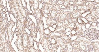 PIK3R3 Recombinant Rabbit Monoclonal Antibody