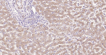 MRP2 Rabbit Monoclonal Antibody