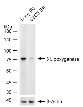 5 Lipoxygenase Recombinant Rabbit Monoclonal Antibody