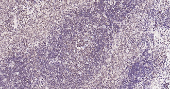 5 Lipoxygenase Recombinant Rabbit Monoclonal Antibody