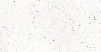 5 Lipoxygenase Recombinant Rabbit Monoclonal Antibody