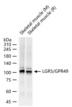 LGR5/GPR49 Recombinant Rabbit Monoclonal Antibody