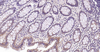 RalA Recombinant Rabbit Monoclonal Antibody