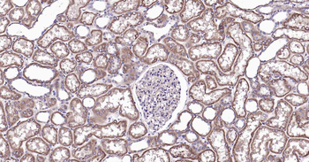 RalA Recombinant Rabbit Monoclonal Antibody