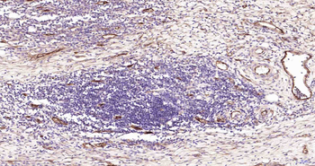 CD105 Recombinant Rabbit Monoclonal Antibody
