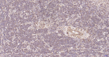 ULK1 Recombinant Rabbit Monoclonal Antibody