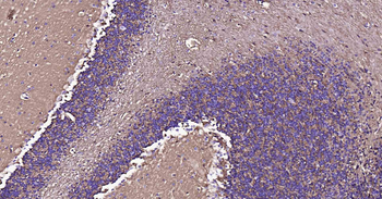 AQP4 Recombinant Rabbit Monoclonal Antibody