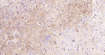 AQP4 Recombinant Rabbit Monoclonal Antibody