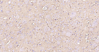 AQP4 Recombinant Rabbit Monoclonal Antibody