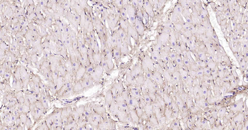 Collagen VI Recombinant Rabbit Monoclonal Antibody