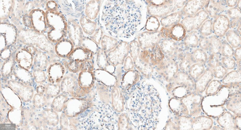 GABARAP Recombinant Rabbit Monoclonal Antibody