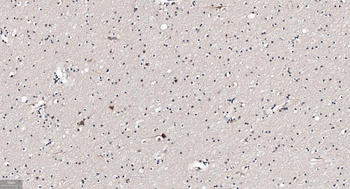 GABARAP Recombinant Rabbit Monoclonal Antibody