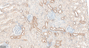 GABARAP Recombinant Rabbit Monoclonal Antibody