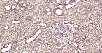 Glucose 6 phosphate isomerase Recombinant Rabbit Monoclonal Antibody