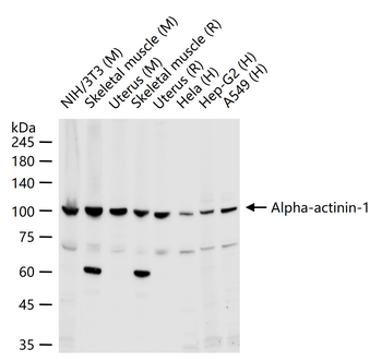 Alpha-actinin-1 Rabbit Polyclonal Antibody