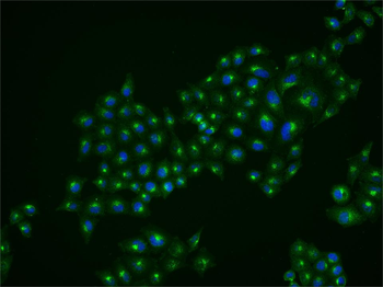 TFRC Mouse Monoclonal Antibody