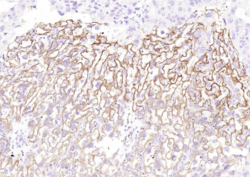 TFRC Rabbit Polyclonal Antibody