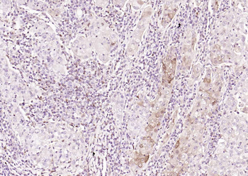 S100A4 Mouse Monoclonal Antibody