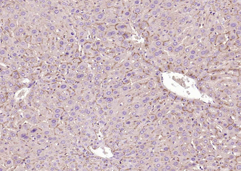 CD26/DPP4 Recombinant Rabbit Monoclonal Antibody