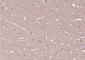 CD90/Thy1 Recombinant Rabbit mAb