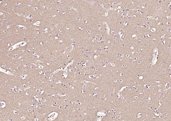 CD90/Thy1 Recombinant Rabbit mAb