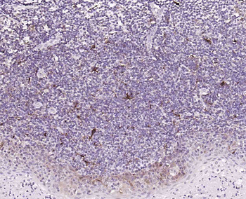 IL18 Recombinant Rabbit Monoclonal Antibody