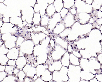 VIPR2 Rabbit Polyclonal Antibody