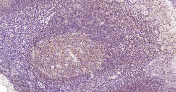 CD19 Recombinant Rabbit Monoclonal Antibody