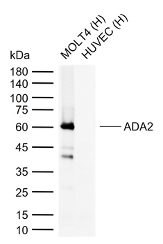 ADA2 Recombinant Rabbit Monoclonal Antibody