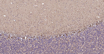 NEFH Recombinant Rabbit Monoclonal Antibody