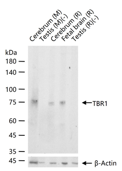 TBR1 Recombinant Rabbit Monoclonal Antibody