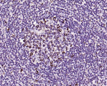HAVCR2/TIM-3 Mouse Monoclonal Antibody