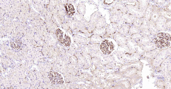 CD34 Recombinant Rabbit Monoclonal Antibody