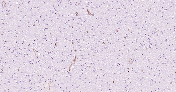 CD34 Recombinant Rabbit Monoclonal Antibody