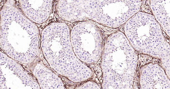 CD34 Recombinant Rabbit Monoclonal Antibody