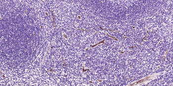 CD34 Recombinant Rabbit Monoclonal Antibody