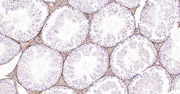 CD34 Recombinant Rabbit Monoclonal Antibody