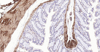 CNN1 Recombinant Rabbit Monoclonal Antibody
