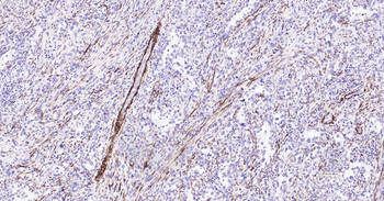 CNN1 Recombinant Rabbit Monoclonal Antibody