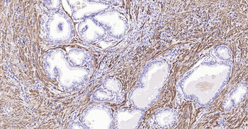 CNN1 Recombinant Rabbit Monoclonal Antibody