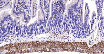 CNN1 Recombinant Rabbit Monoclonal Antibody