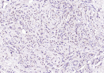 Estrogen receptor alpha Recombinant Rabbit Monoclonal Antibody