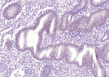 Estrogen receptor alpha Recombinant Rabbit Monoclonal Antibody
