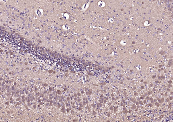 PGP9.5 Mouse Monoclonal Antibody