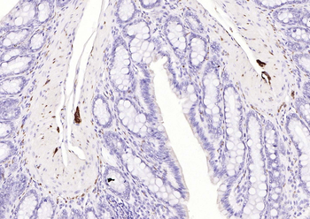 PGP9.5 Mouse Monoclonal Antibody