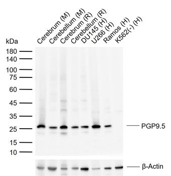 PGP9.5 Mouse Monoclonal Antibody