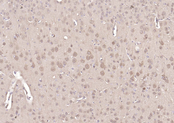 PGP9.5 Mouse Monoclonal Antibody