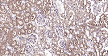 DDIT3 Recombinant Rabbit Monoclonal Antibody